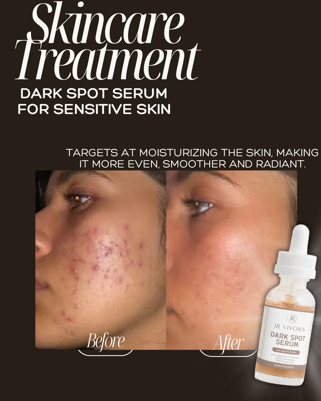 Dark Spot Serum for Sensitive Skin